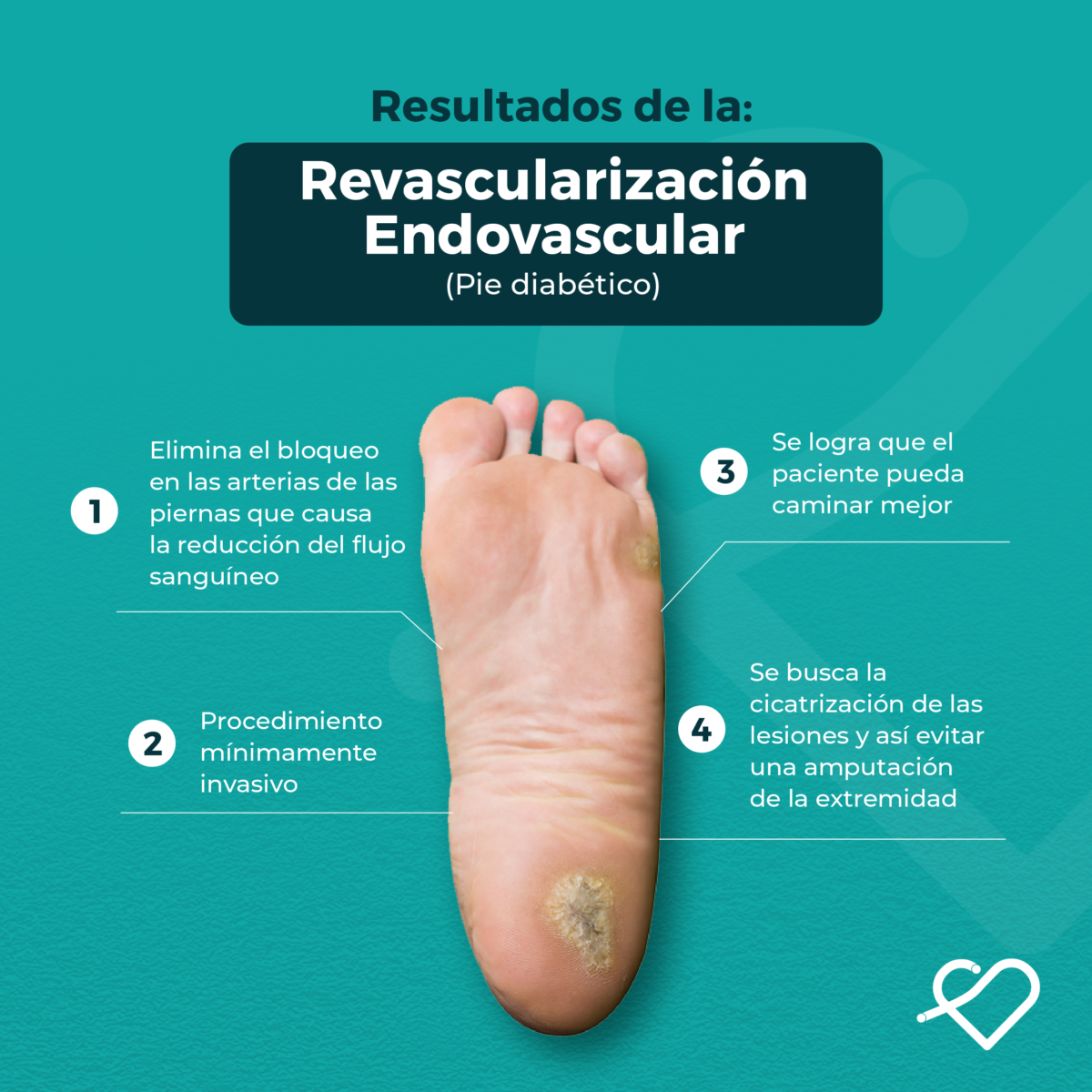  Angioplastía de Miembros Inferiores