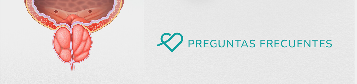 Embolización prostática